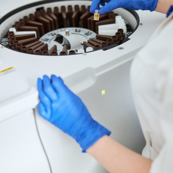 Cropped photo of a chemist in sterile gloves holding a serum vial over the sample tray of a biochemistry analyzer